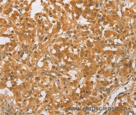 Cebp Beta Polyclonal Antibody 专业科研用生物实验试剂生产商 Elabscience 【官方网站】