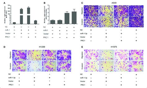 Mir P Inhibits Luad Cell Migration And Invasion Via Prc A B