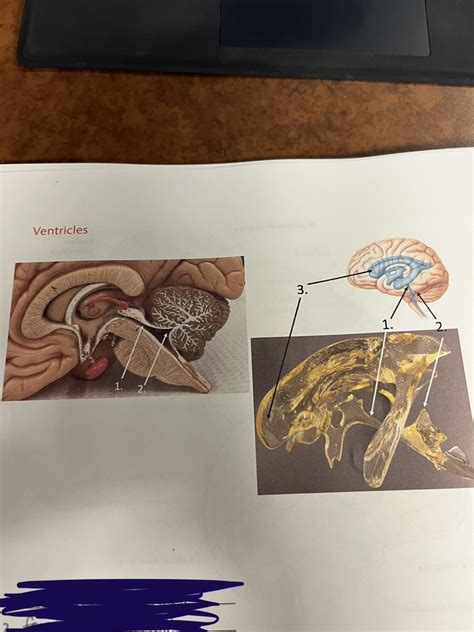 Ventricles Diagram Quizlet