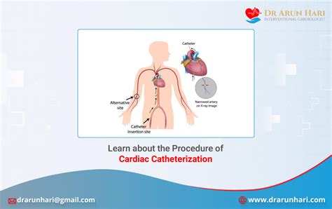 Cardiac Catheterization Procedure Explained - Dr Arun Hari