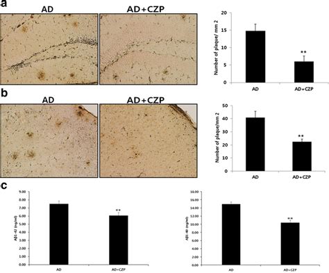 Administration Of Clozapine Reduced Aβ Level And Aβ Plaques In The