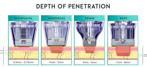 Morpheus Rf Microneedling Edmonton Nakatsui Dermasurgery