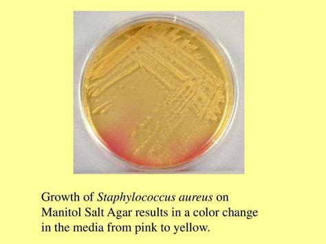 Culturing Microorganism Pure Culture One Consisting Of A Single Type