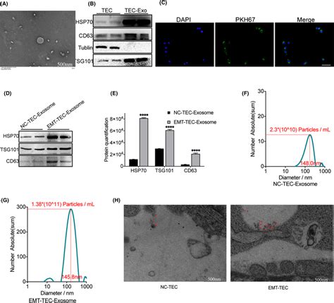 Secretion Of Exosomes By Tecs Under Different Stimulations A