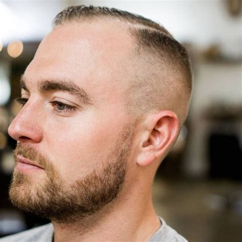 Pourquoi Le Buzz Cut Est Un Choix Gagnant Contre La Calvitie