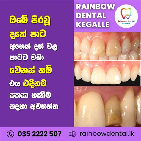 Rainbow Dental Hospital Kegalle