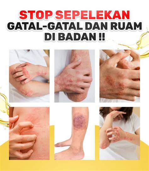 Minyak Balur Ampuh Atasi Segala Gatal Minyak Balur Waji