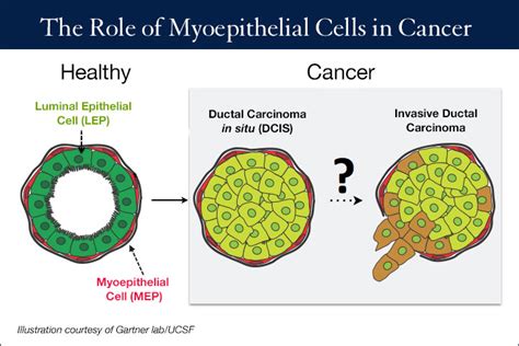 Building Human Breast Tissue Cell By Cell Uc San Francisco