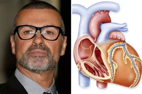 George Michael cause of death revealed by coroner - Mirror Online