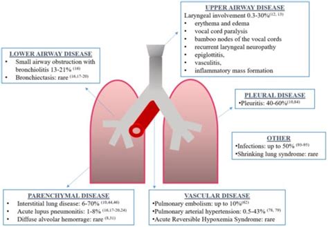 Pharmaceuticals Free Full Text Respiratory Manifestations In Systemic Lupus Erythematosus