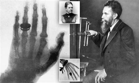 From 1895 to Present: How Radiology Transformed Medicine - SensaWeb