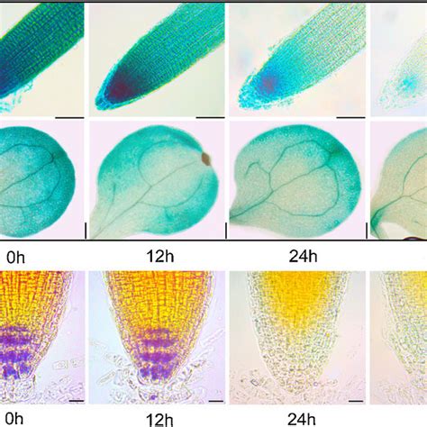 Effects Of Cd Stress On Root Architecture In Arabidopsis Seedlings