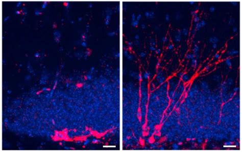 Neurog Nesis Qu Es Y C Mo Incrementarla Salud Y Belleza