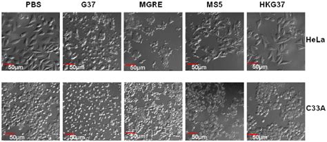 Microscopic Observation Of Cytotoxic Effect Of M Genitalium Strains On