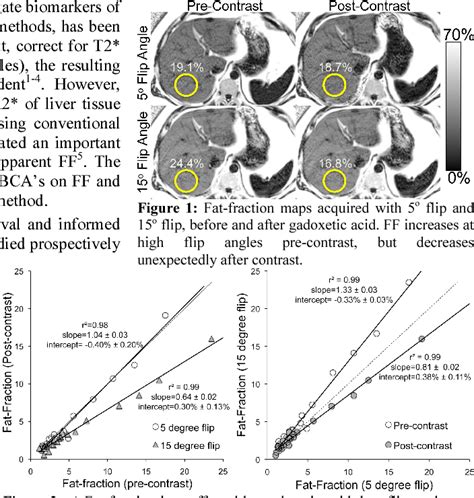 Figure From Effect Of Hepatocyte Specific Gadolinium Based Contrast