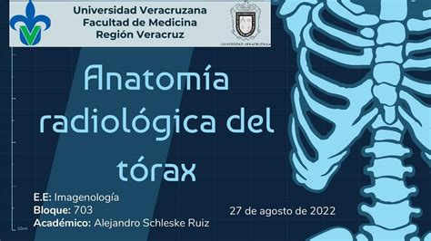 Anatomía Radiológica del Tórax Litzy Marina Aguirre uDocz