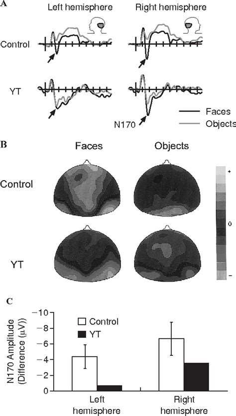 Figure 1 From Cognitive Neuroscience Selective Visual Streaming In