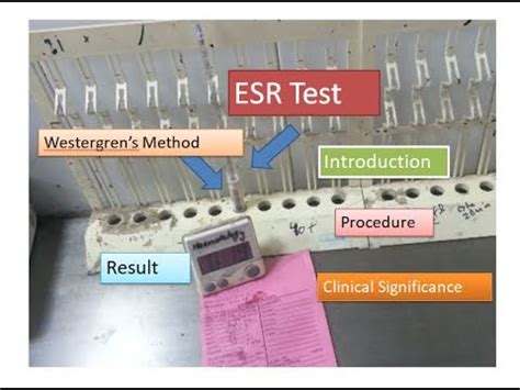 ESR Test Introduction Procedure Result And Clinical Significance