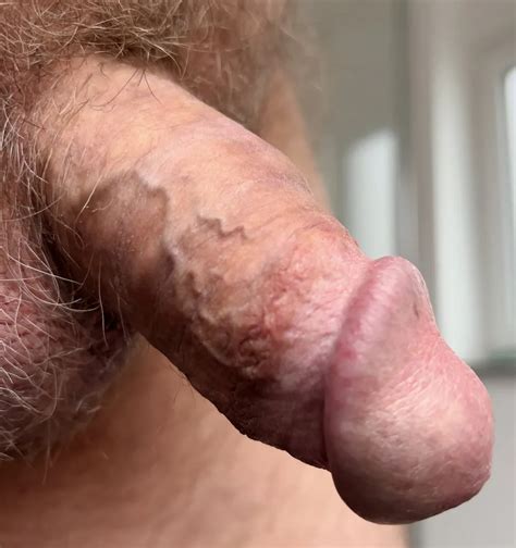 Mann Mit Bauch Cock Close Ups Nude Pics XHamster