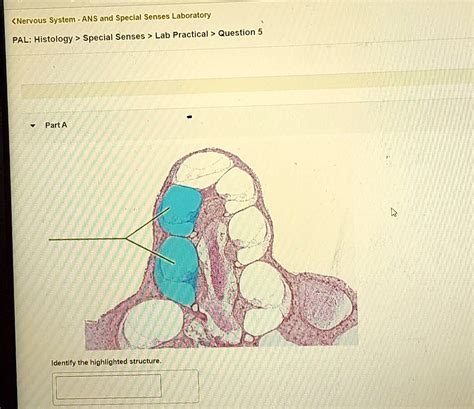 SOLVED Nervous System ANS And Special Senses Laboratory PALHistology