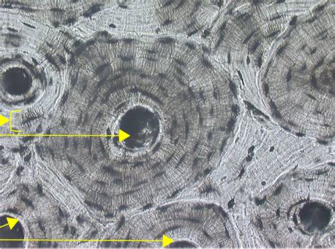 Compact Bone X Diagram Quizlet