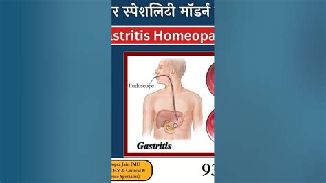 Gastritis Patient Treatment At Aarogya Super Specialty Modern