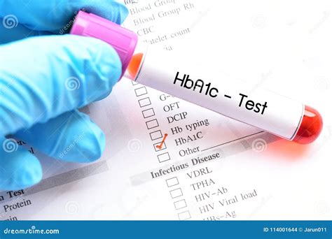 Blood Sample For HbA1c Test Stock Photo Image Of Medicine Hemoglobin