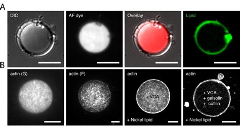 In Vitro Reconstitution Of The Actin Cytoskeleton Inside Giant