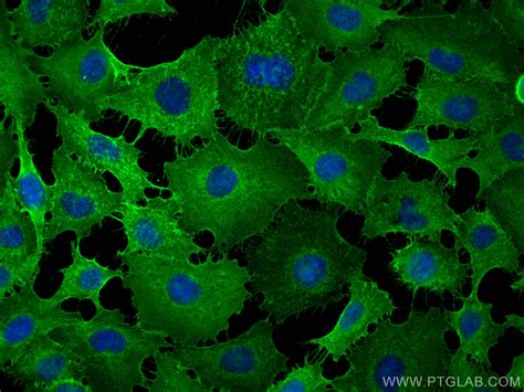 Cd44 Antibody 15675 1 Ap Proteintech 武汉三鹰生物技术有限公司