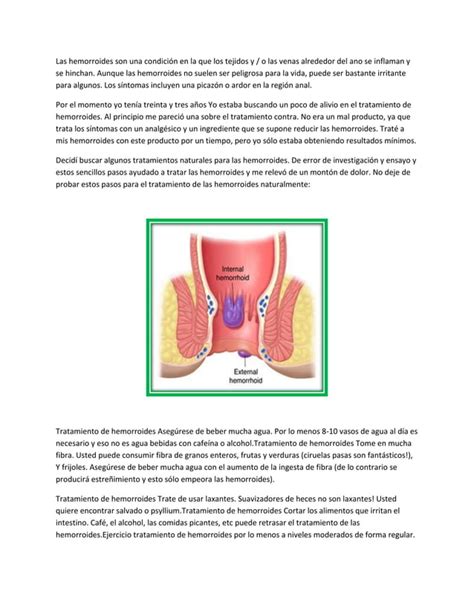 De Hemorroides Tratamiento Pdf