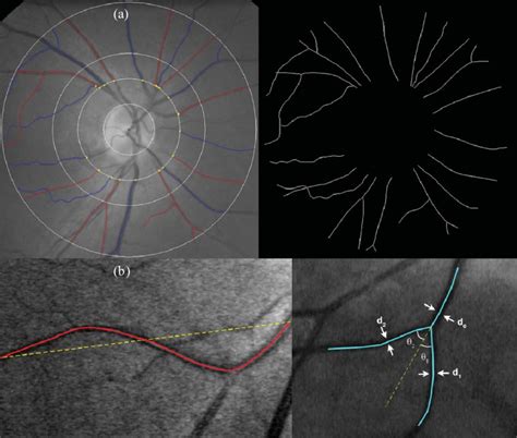 Measurement Of Novel Retinal Vascular Network Parameters A Fractal