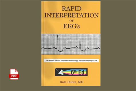 Rapid Interpretation Of Ekg S Sixth Edition Etsy