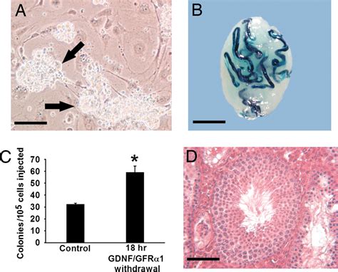 Identifying Genes Important For Spermatogonial Stem Cell Self Renewal