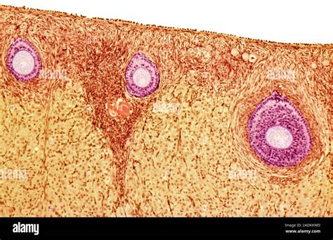 Ovarian Follicles Coloured Light Micrograph Of A Section Through An