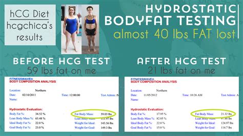 Should You Add Lipo Or Mic Shots To Your Hcg Injections On The Hcg Diet