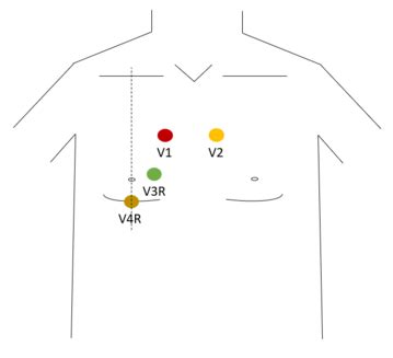 Ecg R Alisation Uness Wiki Ecg