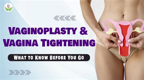 Vaginoplasty And Vagina Tightening What To Know Before You Go Care