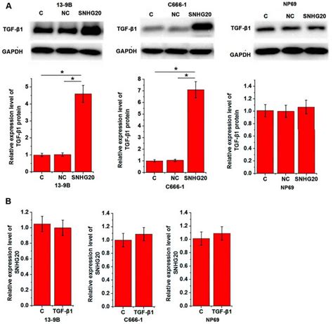 Long Noncoding Rna Snhg Promotes Nasopharyngeal Carcinoma Cell