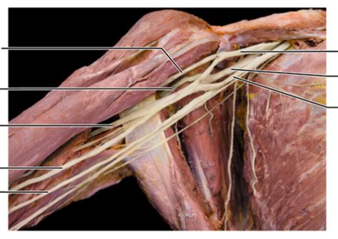 Brachial Plexus Diagram Quizlet