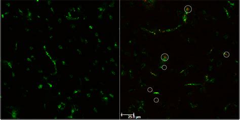 Liposomal Conjugates for Drug Delivery to the Central Nervous System