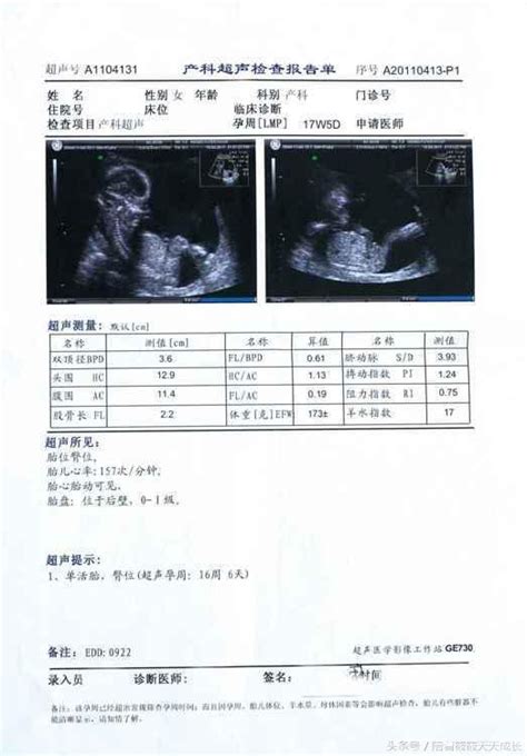 B超單怎麼看，新手媽的煩惱看懂b超報告單 每日頭條