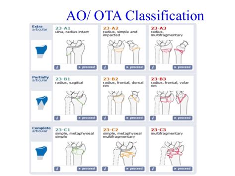 Distal Radius Fractures Trauma Orthobullets