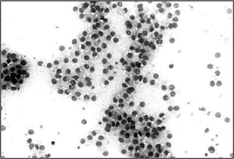 Role Of Fine Needle Aspiration Cytology In Nonneoplastic Testicular And