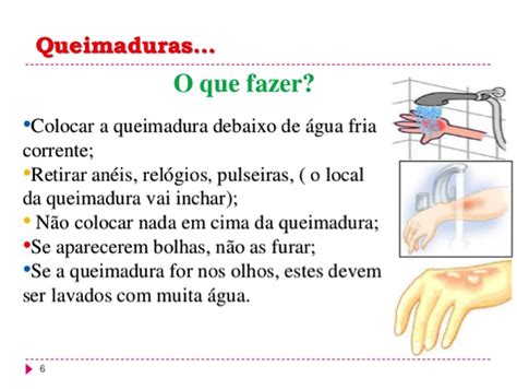 Queimaduras Prevenção De Acidentes De Trânsito E Suporte Básico De Vida