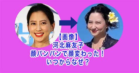 【画像】河北麻友子は顔パンパンで顔変わった！いつからなぜ？ エンタメファミリー