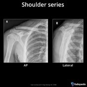 Playlist Rotorua Teaching Shoulder Radiographs By Dr Matt Adams