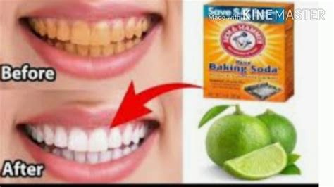 Teeth Whitening At Home In 3 Minutes How To Whiten Your Yellow Teeth Naturally 100