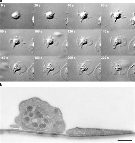 Platelet Spreading A Washed Platelets Were Perfused Over A