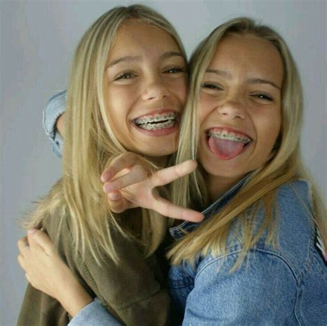 Pin By Bruna Torres 👑 On • Lisa And Lena • Braces Girls Lisa Or Lena