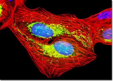 Molecular Expressions Microscopy Primer Specialized Microscopy